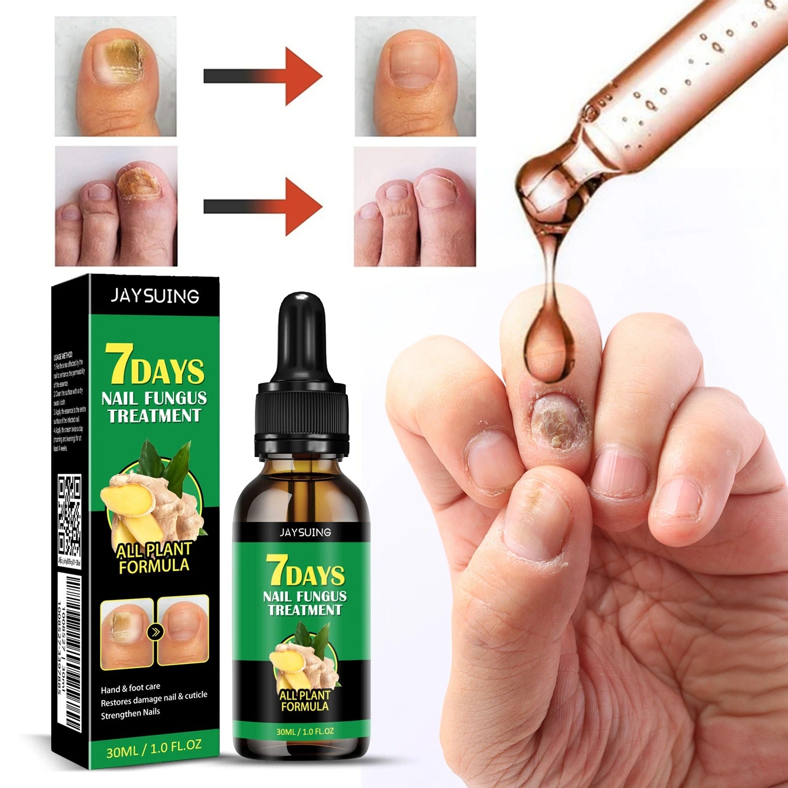 Sérum 7 DAYS Nail fungus puissantes réparatrices pour ONGLES ABIMÉS & FRAGILISÉS